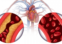 Heart Health and Cholesterol