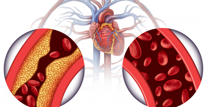 Heart Health and Cholesterol